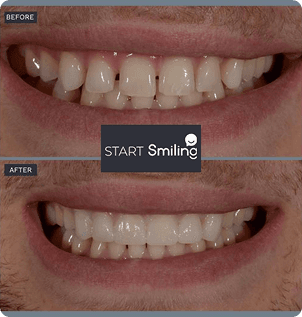 Smile gallery 2