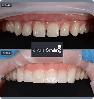 Smile gallery 3
