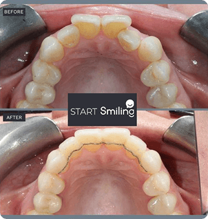 Smile gallery 4