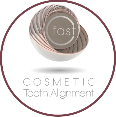 Aligners at Start Smiling Dentist in Essex