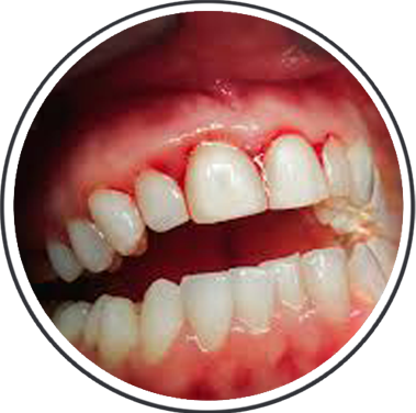 General Dentistry at Start Smiling Dentist in Essex