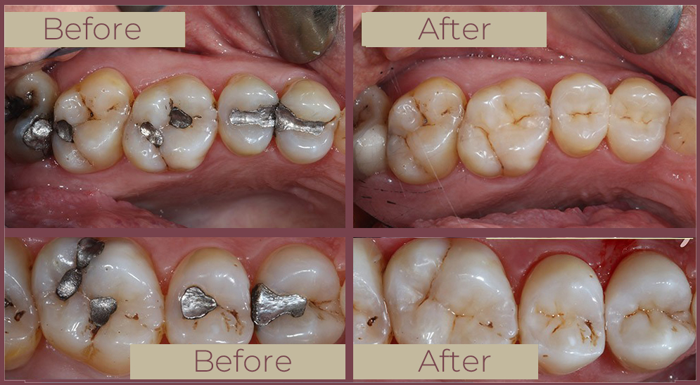 General Dentistry at Start Smiling Dentist in Essex