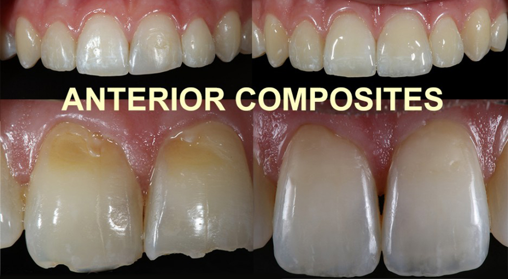 Maintaining Your Smile at Start Smiling in Essex