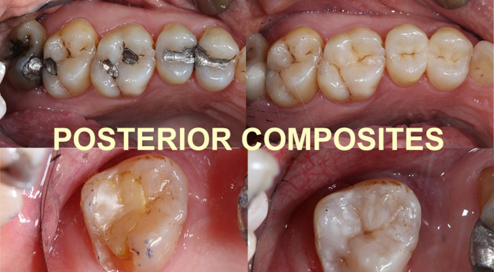 Maintaining Your Smile at Start Smiling in Essex