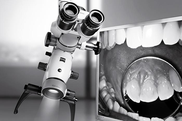 Root Canal Treatment at Start Smiling Dentist in Essex