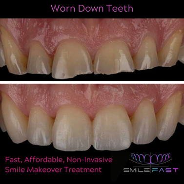 Smile Gallery at Start Smiling Dentist in Essex