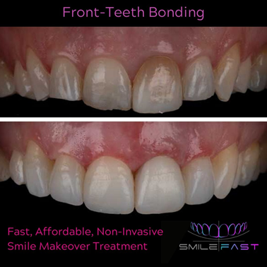Smile Gallery at Start Smiling Dentist in Essex