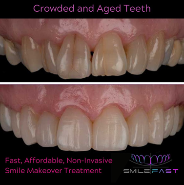 Smile Gallery at Start Smiling Dentist in Essex