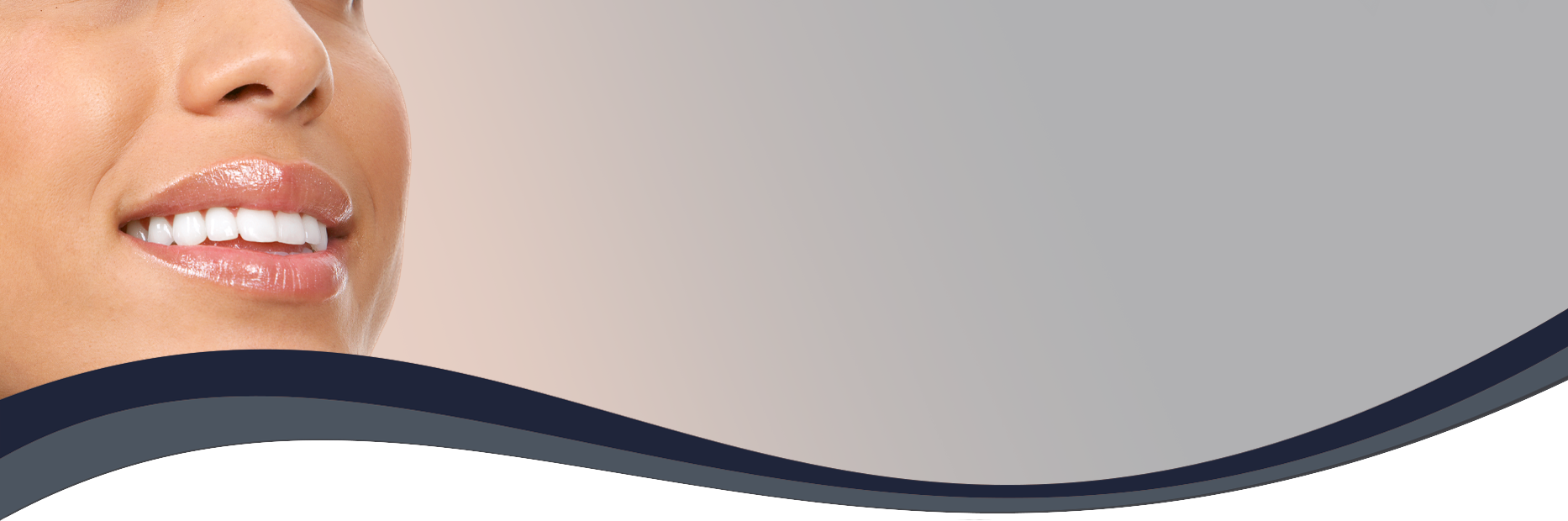 Straight Teeth Dental Treatment at Start Smiling Dentist in Essex