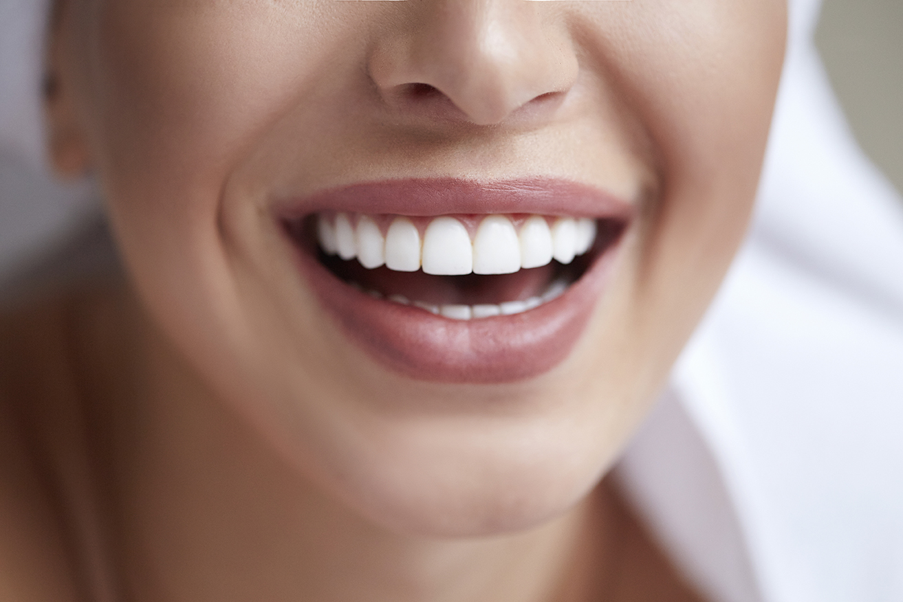 Dental Veneers at Start Smiling Dentist in Essex